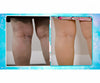 Veins Gone 2x1 a 202 LEU